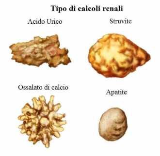 Tipo-di-calcoli-renali